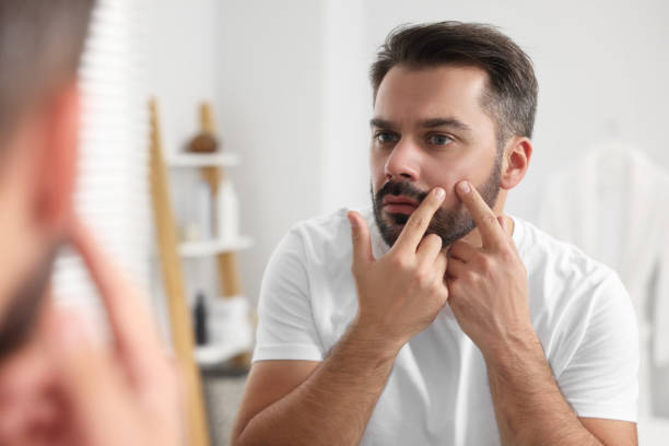 Remedies for Hormonal Imbalance in Men